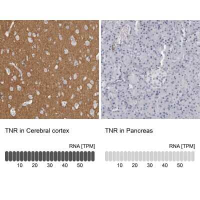 Immunohistochemistry-Paraffin: Tenascin R Antibody [NBP1-86399]