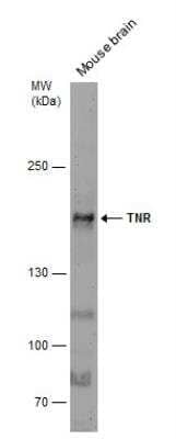 Western Blot: Tenascin R Antibody [NBP2-20677]