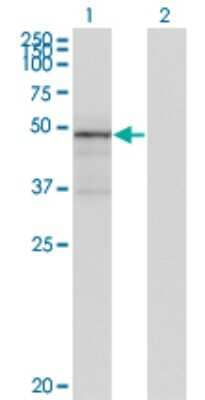 Western Blot: Tenascin X Antibody (2D3-1B10) [H00007148-M01]