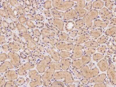 Immunohistochemistry-Paraffin: Tenascin X Antibody [NBP2-99638]