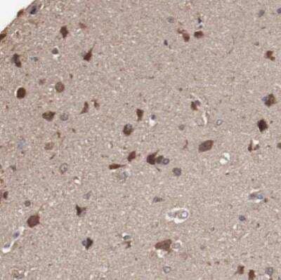 Immunohistochemistry-Paraffin: Teneurin-1 Antibody [NBP2-52739]