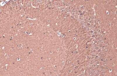 Immunohistochemistry-Paraffin: Teneurin-1 Antibody [NBP3-13409]