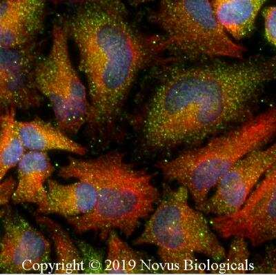 Immunocytochemistry/ Immunofluorescence: Tensin 1 Antibody - BSA Free [NBP2-78783]