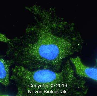 Immunocytochemistry/ Immunofluorescence: Tensin 1 Antibody - BSA Free [NBP2-78783]