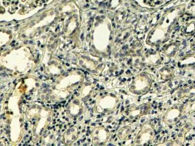 Immunohistochemistry-Paraffin: Tensin 1 Antibody [NB100-41087]