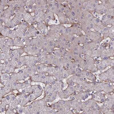 Immunohistochemistry-Paraffin: Tensin 1 Antibody [NBP1-84129]