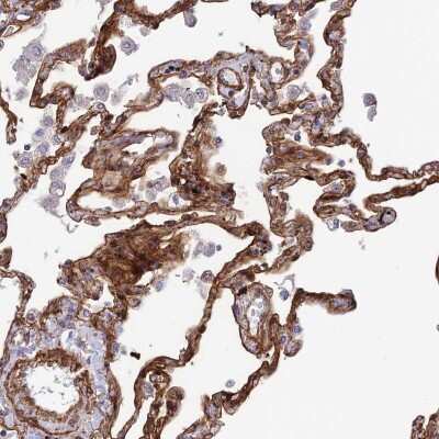 Immunohistochemistry-Paraffin: Tensin 1 Antibody [NBP1-84129]