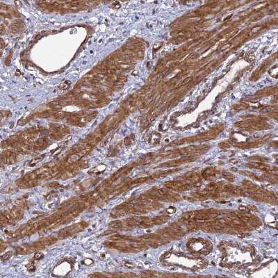 Immunohistochemistry-Paraffin: Tensin 1 Antibody [NBP1-84129]