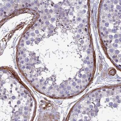 Immunohistochemistry-Paraffin: Tensin 1 Antibody [NBP1-84129]