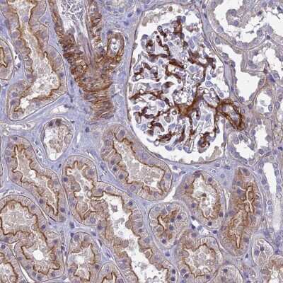 Immunohistochemistry-Paraffin: Tensin 1 Antibody [NBP1-84130]