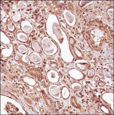 Immunohistochemistry-Paraffin: Tensin 1 Antibody - BSA Free [NBP2-78783]