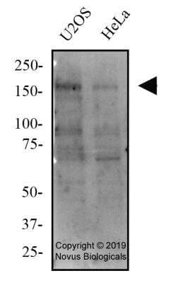 Western Blot: Tensin 1 AntibodyBSA Free [NBP2-78783]