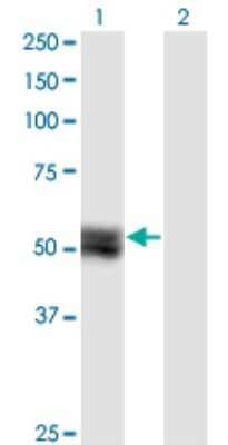 Western Blot: Tensin 4/CTEN Antibody (1C1) [H00084951-M02]