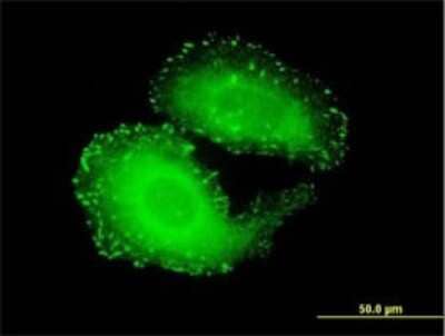 Immunocytochemistry/ Immunofluorescence: Tensin 4/CTEN Antibody (3B8) [H00084951-M01]