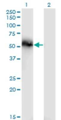 Western Blot: Tensin 4/CTEN Antibody (3B8) [H00084951-M01]