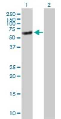 Western Blot: Tensin 4/CTEN Antibody [H00084951-B01P]