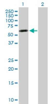 Western Blot: Tensin 4/CTEN Antibody [H00084951-D01P]