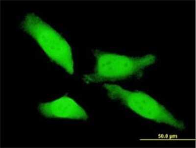 Immunocytochemistry/ Immunofluorescence: Tesmin Antibody (4H4) [H00009633-M01]