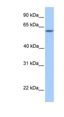 Western Blot: Tesmin Antibody [NBP1-59090]