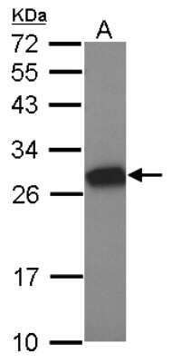 Western Blot: Tesmin Antibody [NBP2-20600]