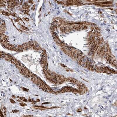 Immunohistochemistry-Paraffin: Testican 1/SPOCK1 Antibody [NBP1-87009]