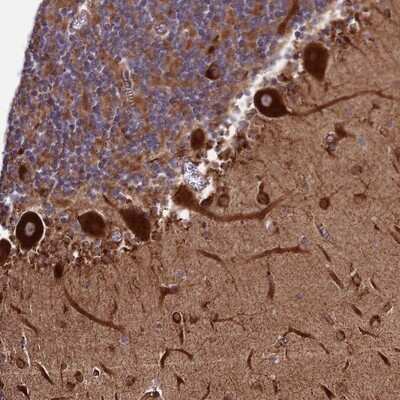 Immunohistochemistry-Paraffin: Testican 2/SPOCK2 Antibody [NBP1-92442]