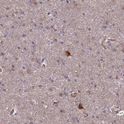 Immunohistochemistry-Paraffin: Testican 2/SPOCK2 Antibody [NBP1-92442]