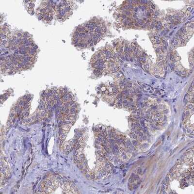 Immunohistochemistry-Paraffin: Testican 2/SPOCK2 Antibody [NBP1-92442]
