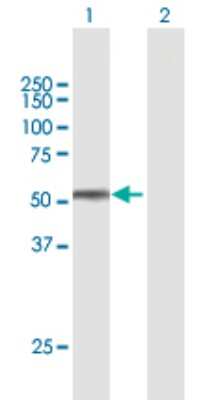 Western Blot: Testican 2/SPOCK2 Antibody [H00009806-B01P]