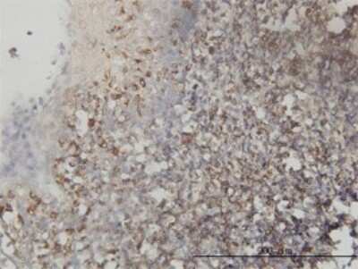 Immunohistochemistry-Paraffin: Testin Antibody (1G11-B7) [H00026136-M01]
