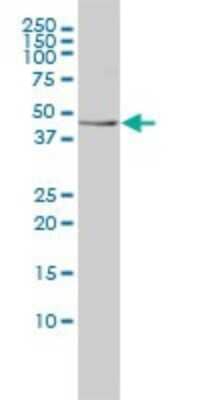 Western Blot: Testin Antibody (1G11-B7) [H00026136-M01]