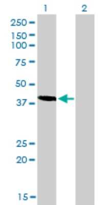Western Blot: Testin Antibody (1G11-B7) [H00026136-M01]
