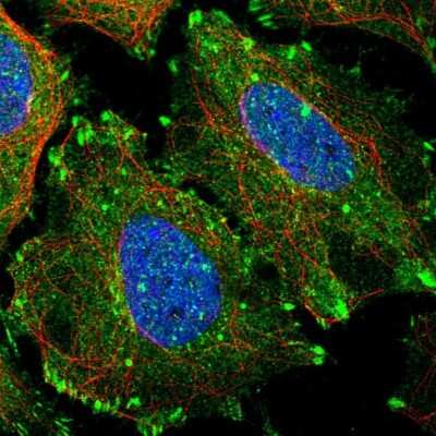 Immunocytochemistry/ Immunofluorescence: Testin Antibody [NBP1-85072]