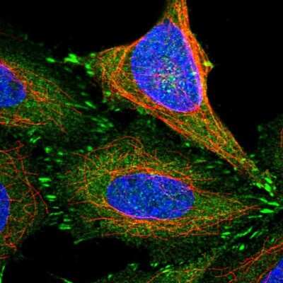 Immunocytochemistry/ Immunofluorescence: Testin Antibody [NBP1-87987]