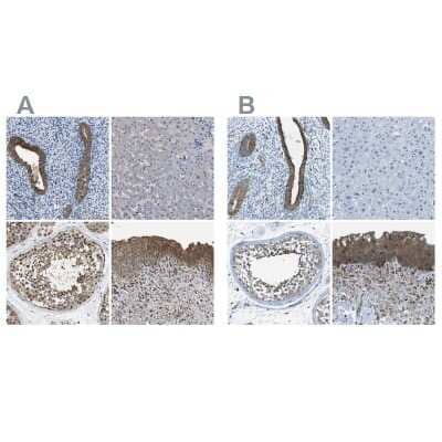 Immunohistochemistry-Paraffin: Testin Antibody [NBP1-85072]