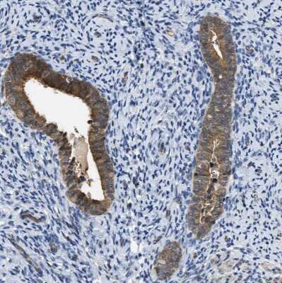 Immunohistochemistry-Paraffin: Testin Antibody [NBP1-85072]