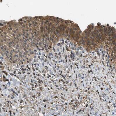 Immunohistochemistry-Paraffin: Testin Antibody [NBP1-85072]