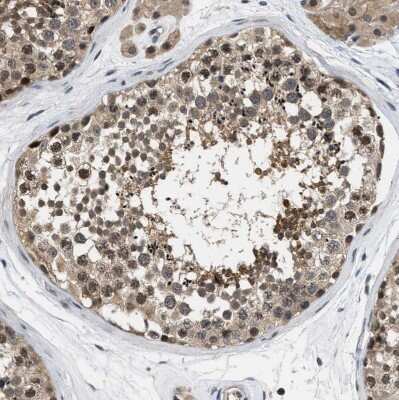 Immunohistochemistry-Paraffin: Testin Antibody [NBP1-85072]