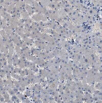 Immunohistochemistry-Paraffin: Testin Antibody [NBP1-85072]