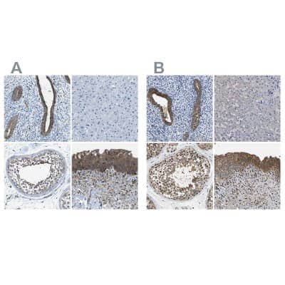 Immunohistochemistry-Paraffin: Testin Antibody [NBP1-87987]