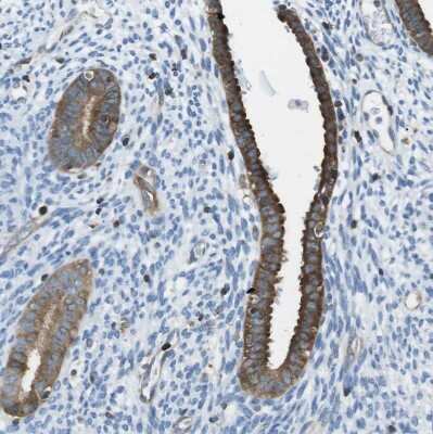 Immunohistochemistry-Paraffin: Testin Antibody [NBP1-87987]