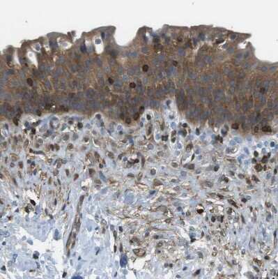 Immunohistochemistry-Paraffin: Testin Antibody [NBP1-87987]
