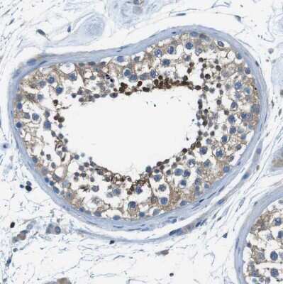 Immunohistochemistry-Paraffin: Testin Antibody [NBP1-87987]