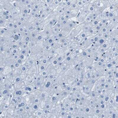 Immunohistochemistry-Paraffin: Testin Antibody [NBP1-87987]