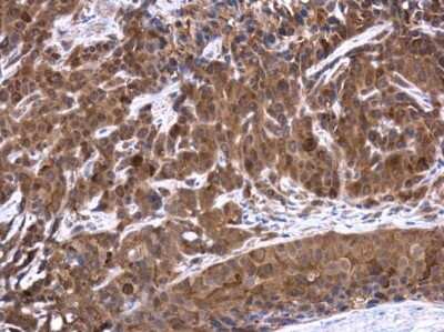 Immunohistochemistry-Paraffin: Testin Antibody [NBP3-12938]