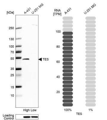 Western Blot: Testin Antibody [NBP1-85072]