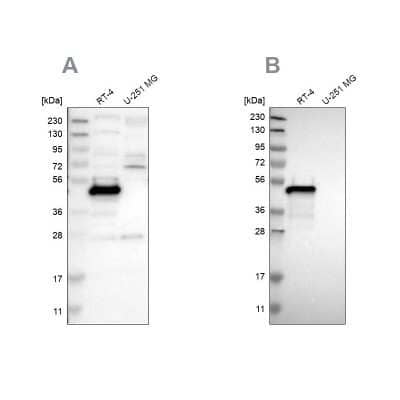 Western Blot: Testin Antibody [NBP1-85072]