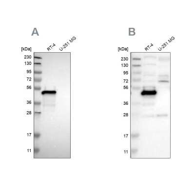 Western Blot: Testin Antibody [NBP1-87987]