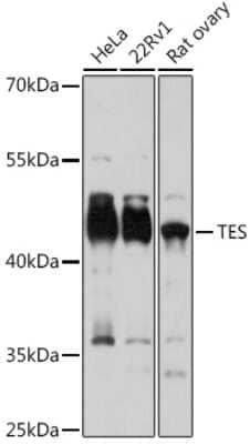 Western Blot: Testin AntibodyAzide and BSA Free [NBP2-94529]