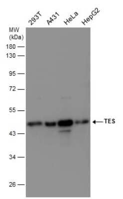 Western Blot: Testin Antibody [NBP3-12938]